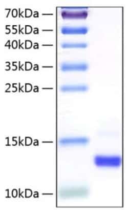 Novus Biologicals Recombinant Human CLPS His (C-Term) Protein 100 &mu;g | Buy Online | Novus Biologicals&trade; | Fisher Scientific
